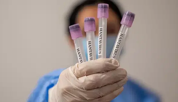profesorden-dikkat-ceken-hantavirus-aciklamasi-yeniden-bir-pandemi-ihtimali-yok-ama-tedbir-sart-GOb5IcN5